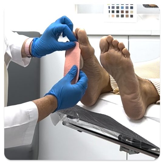 Identify foot corns using Footerella Microscope and use the The Metatarsal Lift and Pull to