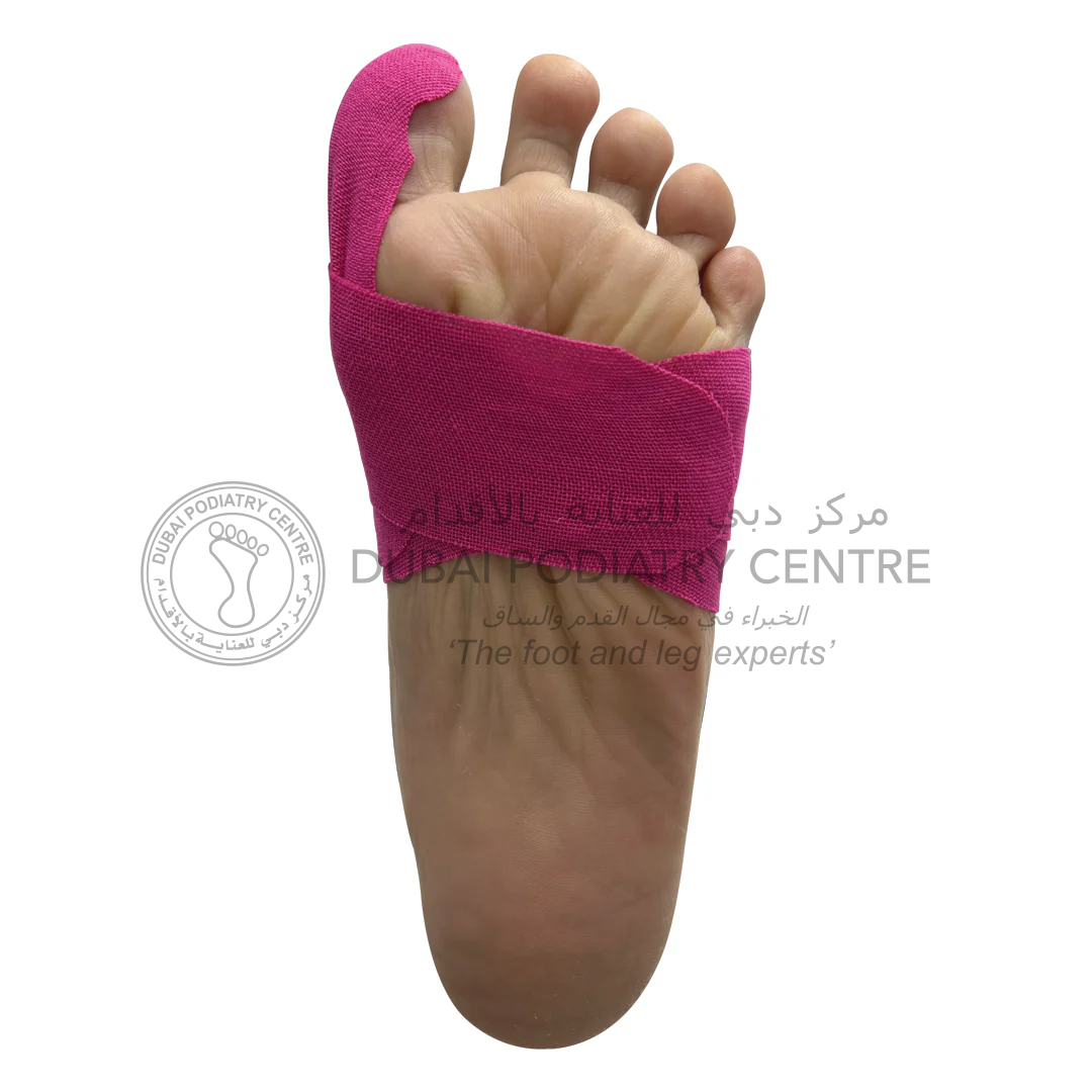 https://dubaipodiatry.com/wp-content/uploads/2025/08/1Bunion-Image1.jpg