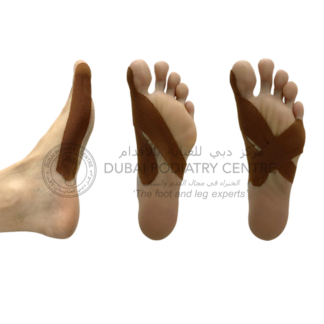 https://dubaipodiatry.com/wp-content/uploads/2025/08/2BunionImage2.jpg