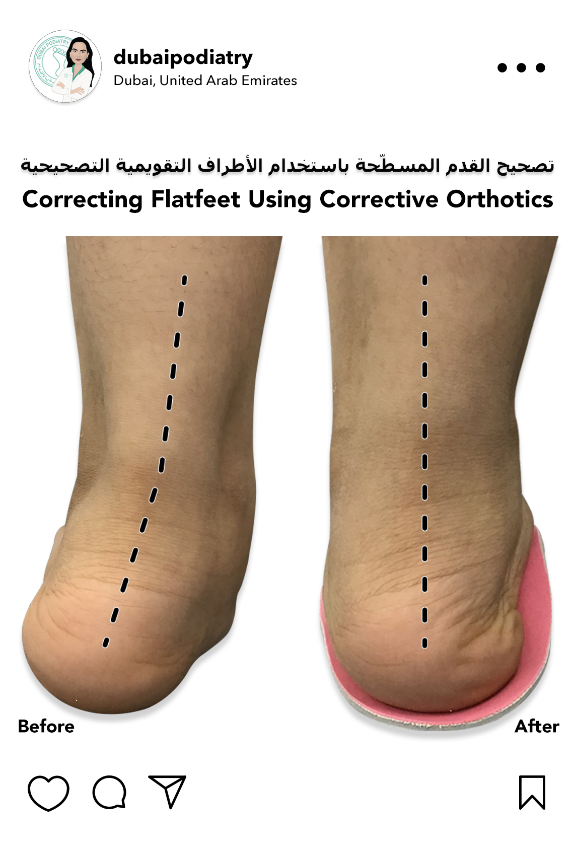 https://dubaipodiatry.com/wp-content/uploads/2025/10/Website-IG-Slide-18_2025.jpg