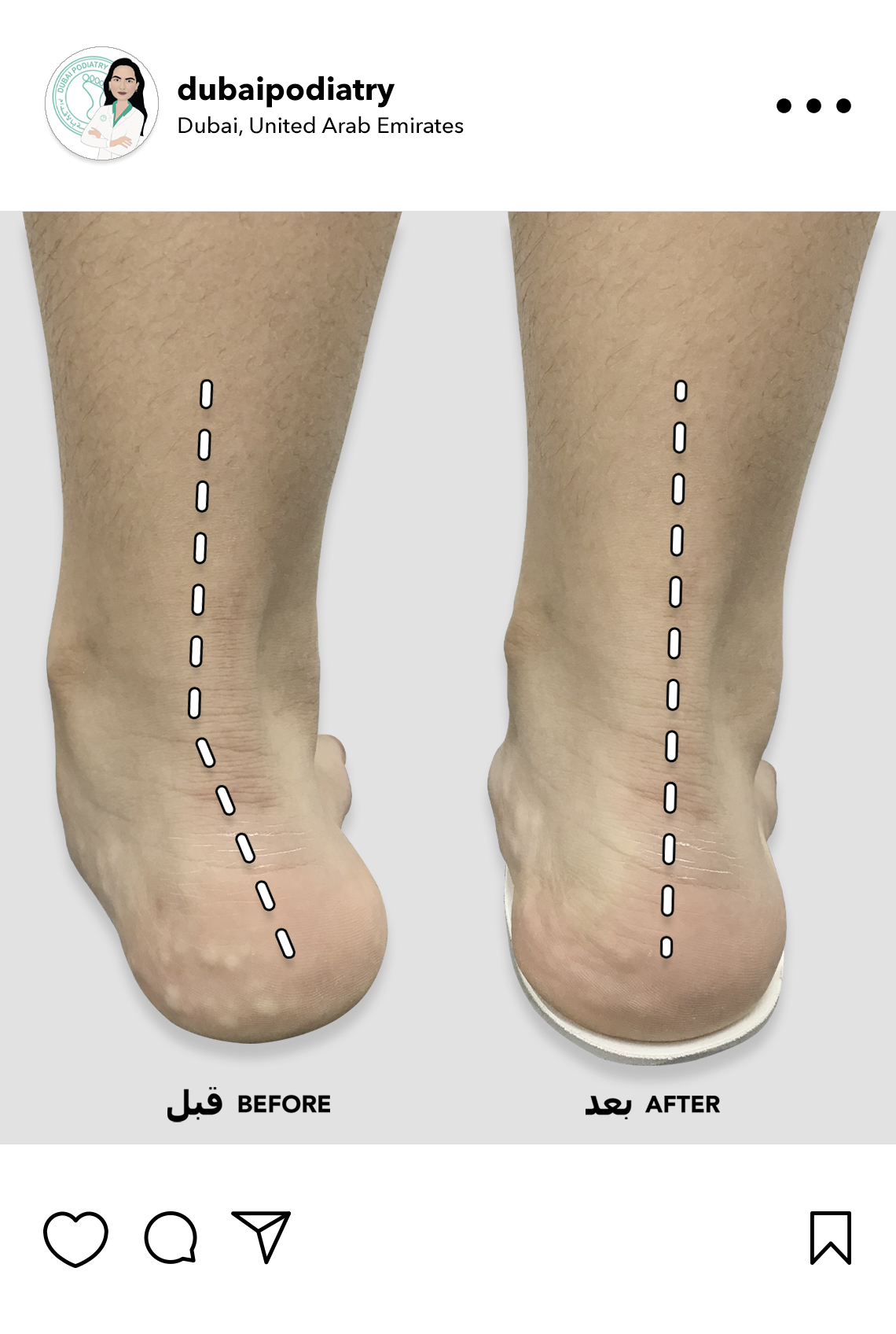https://dubaipodiatry.com/wp-content/uploads/2026/02/Website-IG-Slide-February_2026.jpg