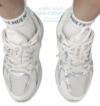 Top view of white trainers showing shoe tongue slipping outward due to foot alignment and possible hyperpronation