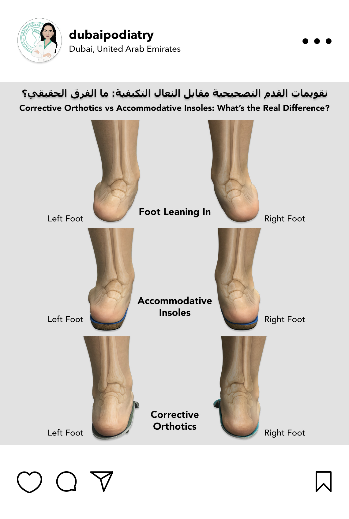 https://dubaipodiatry.com/wp-content/uploads/2026/06/corrective-orthotics-vs-accommodative-insoles-comparison.jpg