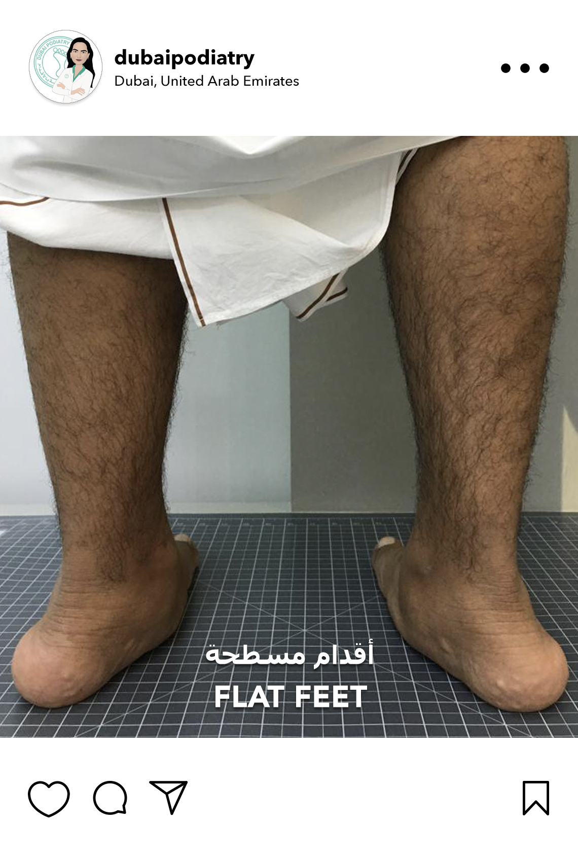 https://dubaipodiatry.com/wp-content/uploads/2026/06/flat-feet-overpronation-rear-view-assessment-dubai-podiatry.jpg
