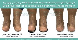 Illustration showing flat feet causing lateral ankle pain, knee pain and hip pain, comparing accommodative insoles with corrective orthotics to improve lower limb alignment