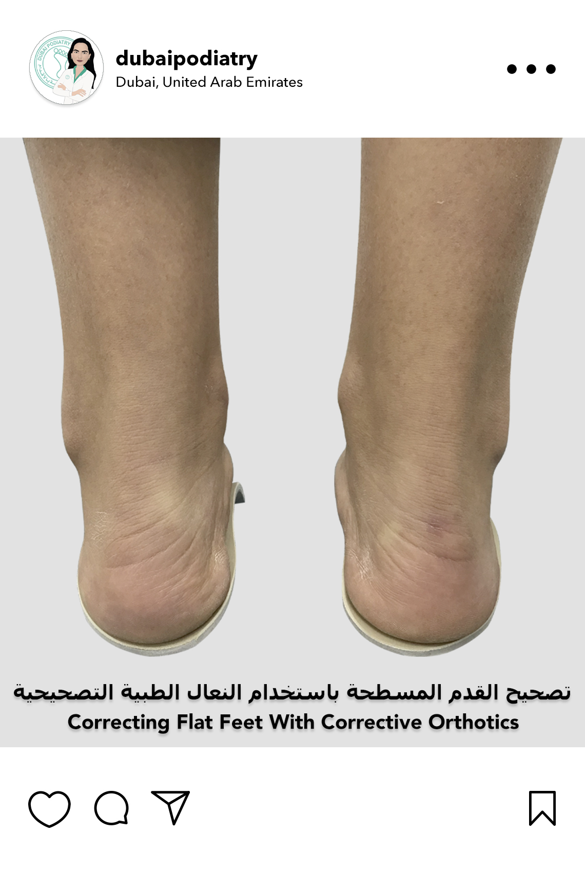 https://dubaipodiatry.com/wp-content/uploads/2026/09/correcting-flat-feet-custom-orthotics-dubai-1.jpg